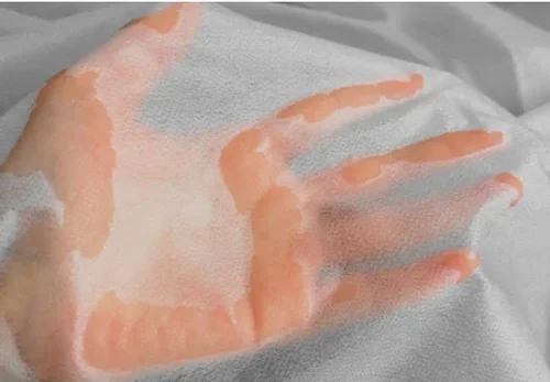 SSS Hydrophilic Nonwoven view 1